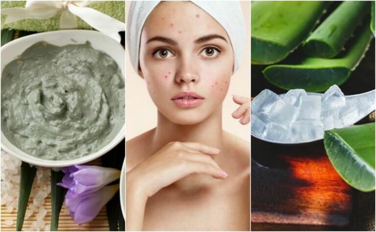 Remedies for pimples on your nose.