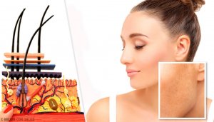 Skin Spots and What Causes Them