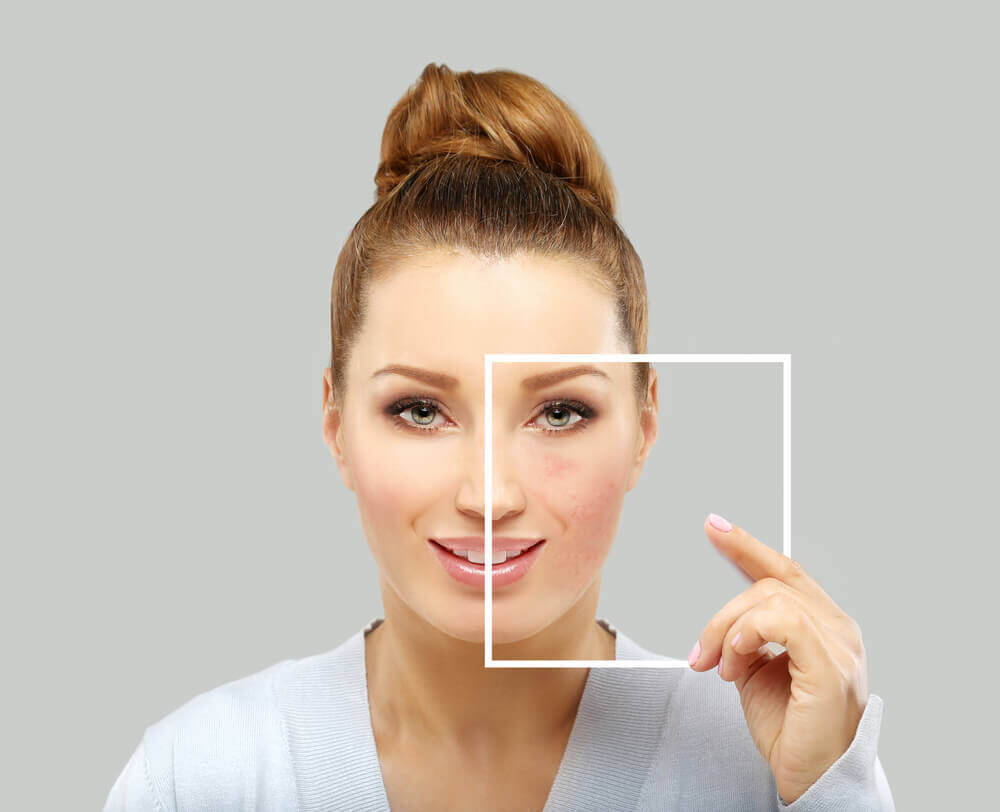 What Gives Your Skin Color?