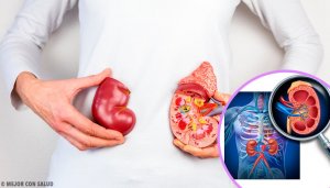 5 Things You Should Know About Kidney Transplants