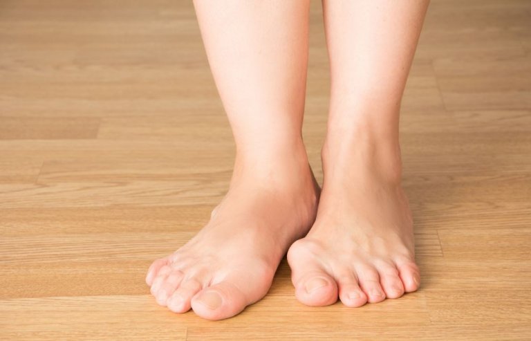 Prevent Bunions with These 5 Tips