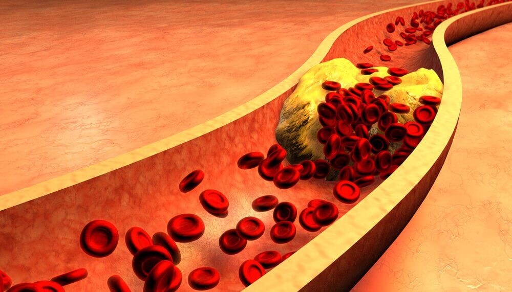 Canary Seed and Cinnamon Water, a Remedy to Clean the Arteries