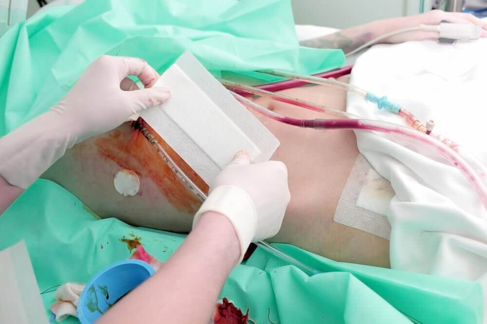 Photo of real-life kidney transplants