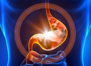 Combat Gastritis With These Natural Remedies