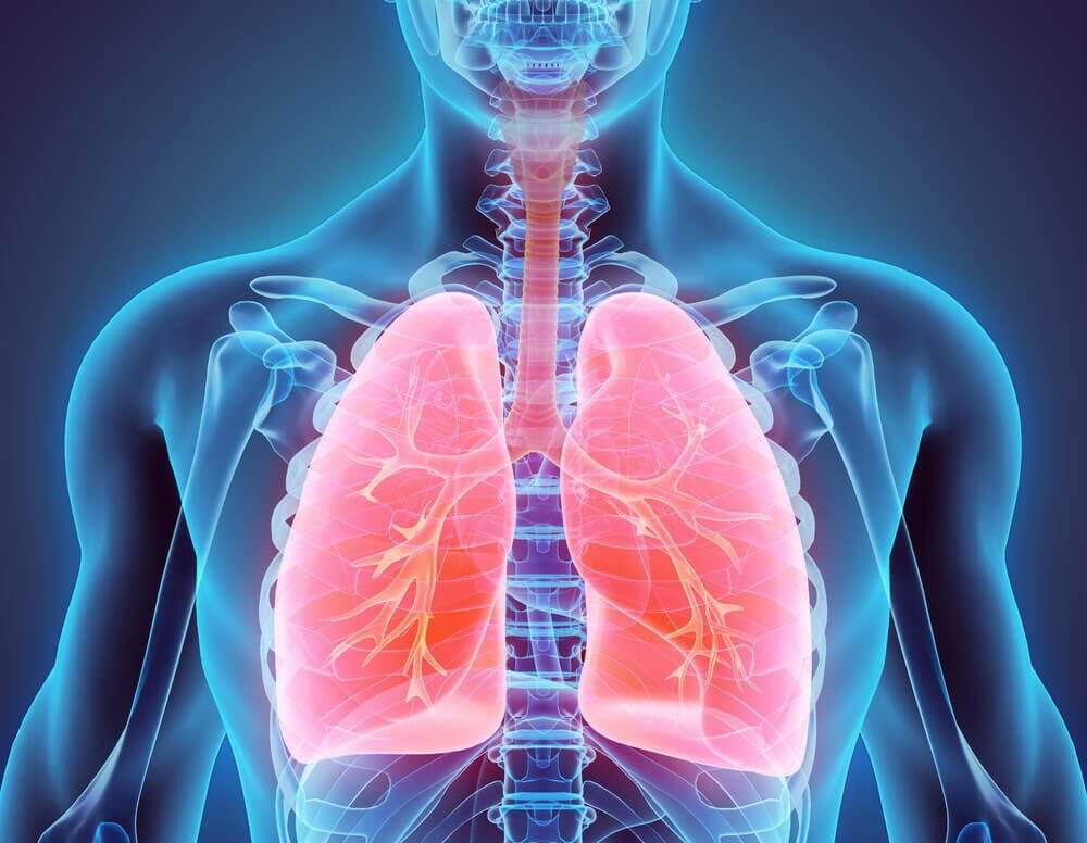 Everything You Need to Know about Bronchiectasis