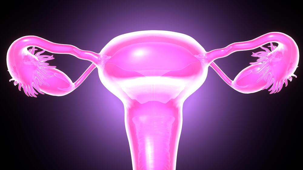Polycystic Ovary Syndrome can cause infertility.