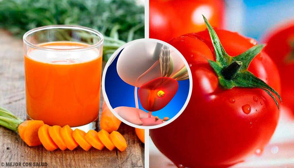 9 Natural Remedies for Prostate Problems — Step To Health