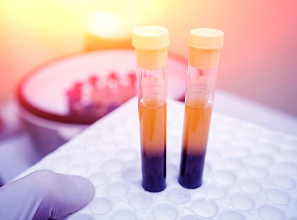 Do You Need to Raise Your Platelet Count? These 4 Remedies Can Help