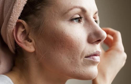 clean your pores