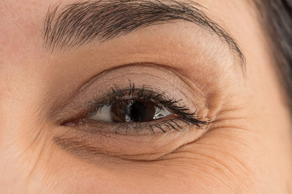 Covering Eye Bags