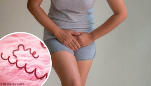 First Symptoms of Syphilis
