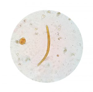 Try These Natural Homemade Cures for Amebiasis