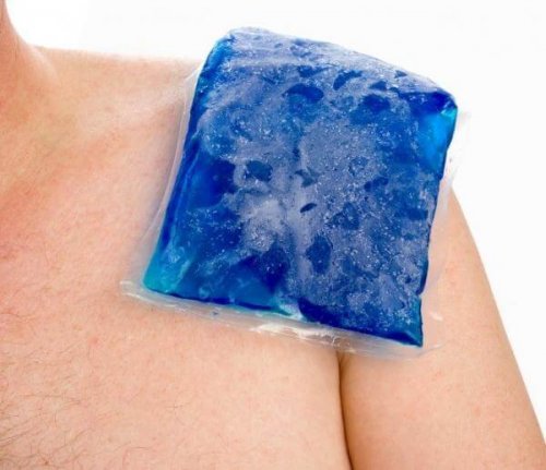 treating bursitis