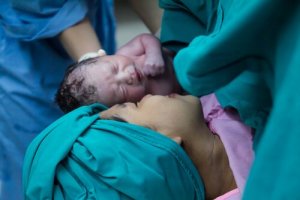 How to Take Care of Yourself After a C-Section