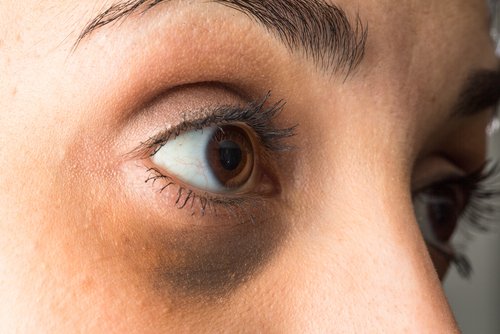 minimize dark circles