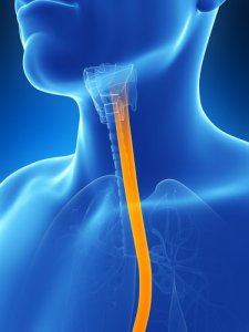 Combat Symptoms of Oesophagitis With 5 Natural Remedies