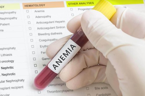 iron-deficiency anemia