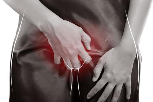 How to Cure Vaginal Candidiasis with Natural Remedies