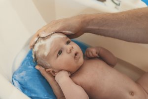 baby after circumcision