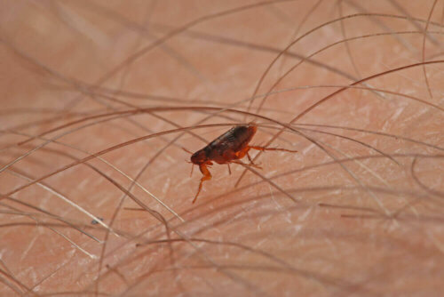 A flea on a person.