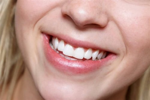 kvinde der smiler