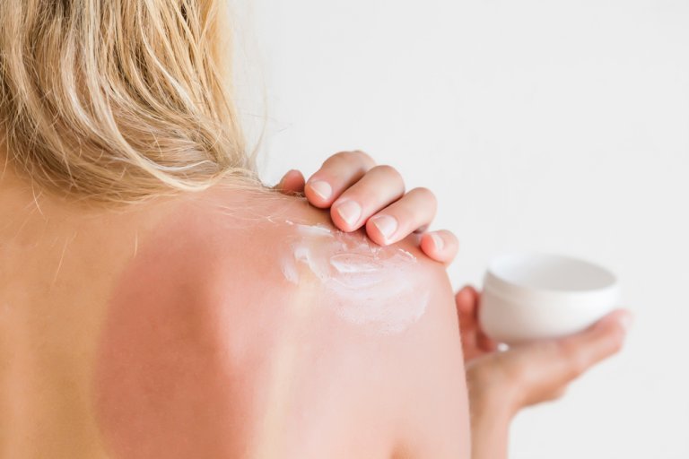 After Sun Lotion or Moisturizer: Which is Best?