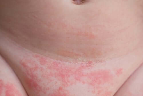 Four Tips to Prevent Diaper Rash