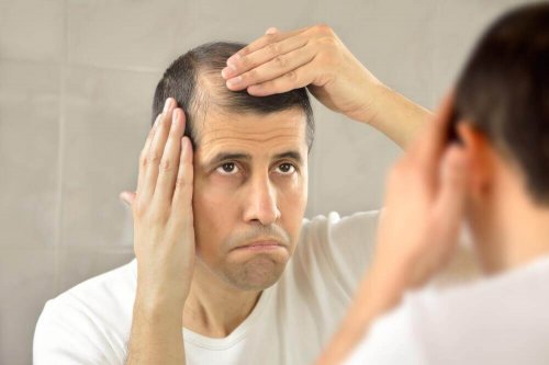 A man who suffers from hair loss looking at himself in the mirror.