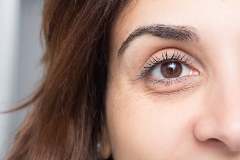 Ten Unfailing Tips to Prevent Puffiness and Dark Circles