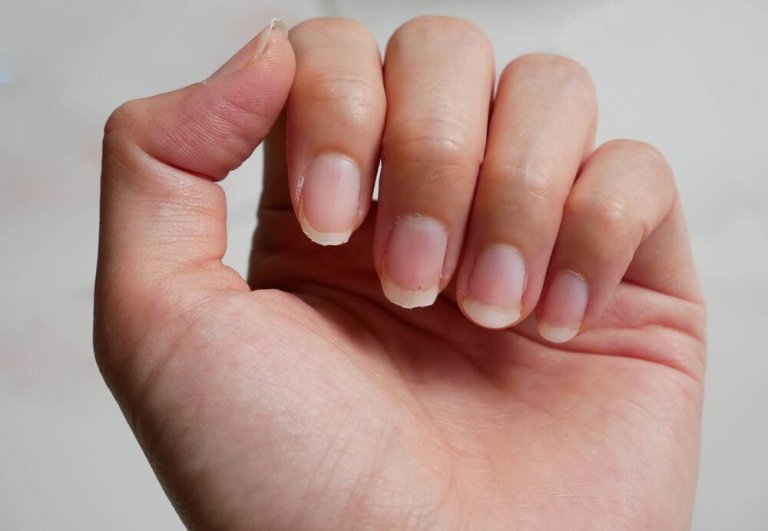 Nine Remedies for Brittle Nails You Need to Know
