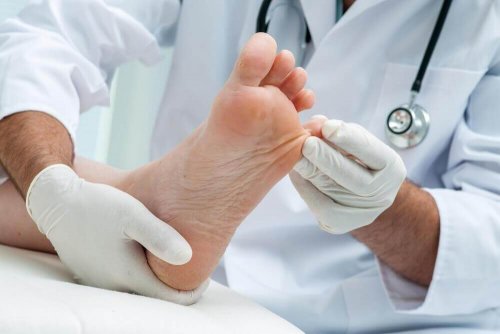 Seven Home Remedies to Treat Superficial Mycoses Naturally