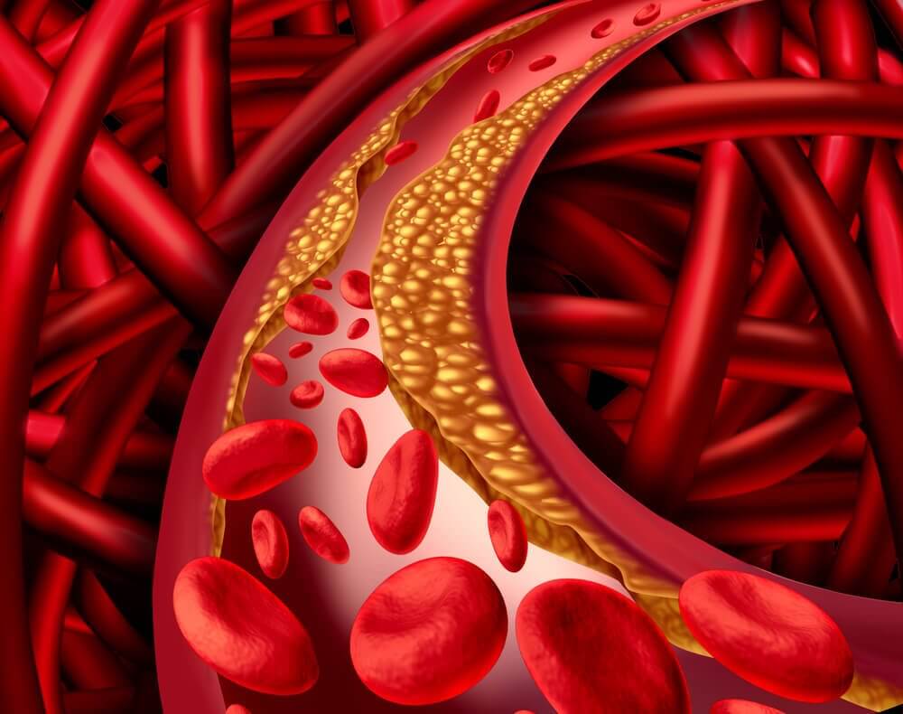 Reduce levels of fat in your blood.