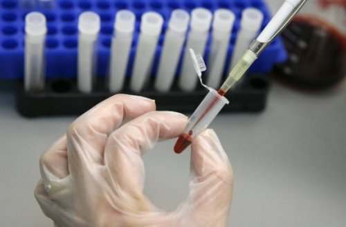 Stem Cell Transplant Could Eradicate HIV