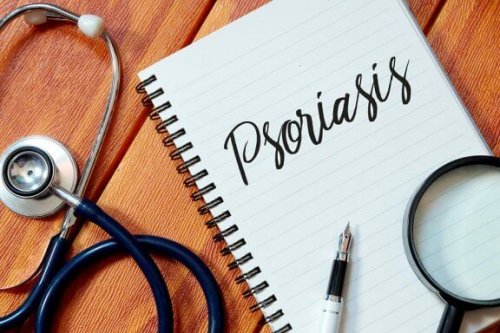Five Ways to Keep Psoriasis at Bay