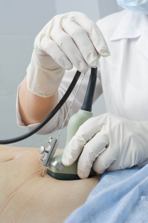 Woman getting checked for molar pregnancy