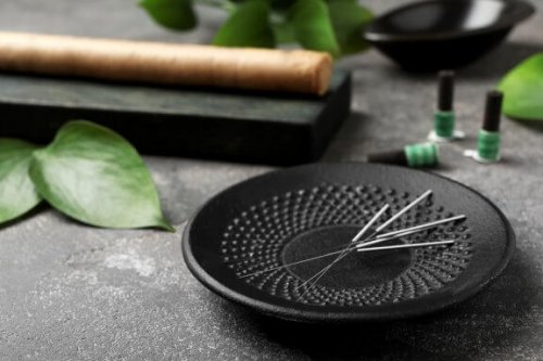 5 Benefits of Acupuncture that You Should Know