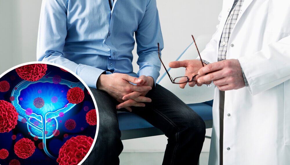 Man take with doctor about benign prostatic hyperplasia