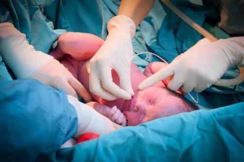 neonatal-death