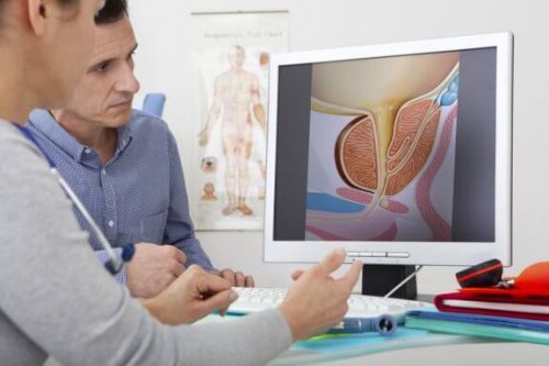What Are the Treatments for Benign Prostatic Hyperplasia?