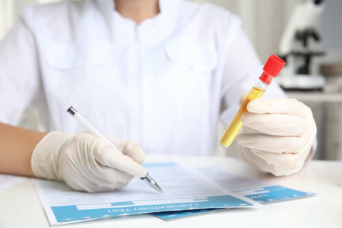 A doctor making notes about urine abnormalities in a sample.