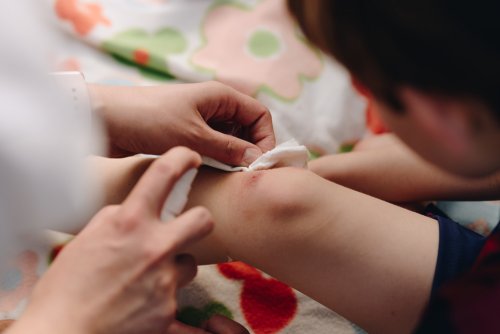 Child getting his wound treated