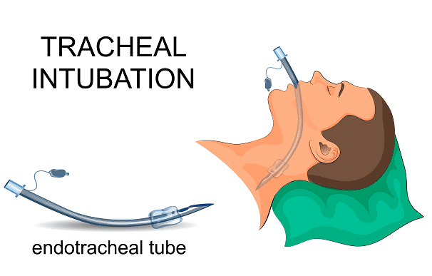 Endotracheal tubes.