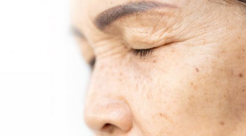 Lift Your Eyelids with 4 Natural Ingredients