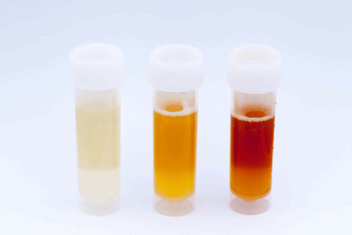 Three urine samples.