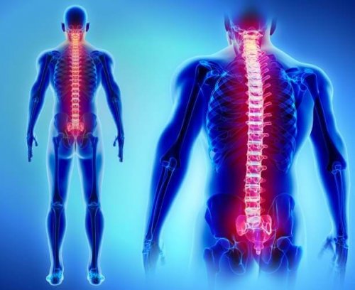 Autonomic hyperreflexia can be deadly.