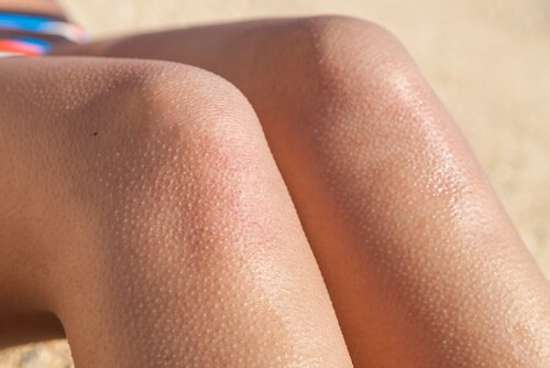 Some legs with goose bumps.
