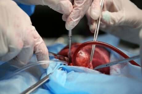 Doctors operating a heart.
