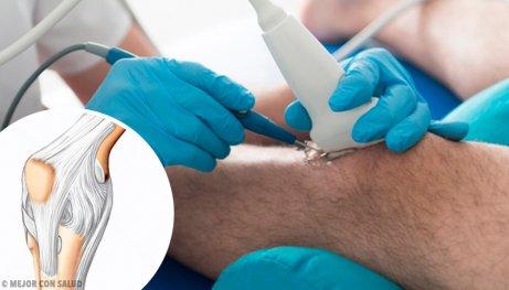 Chirurg wykonujący artroskopię kolana.