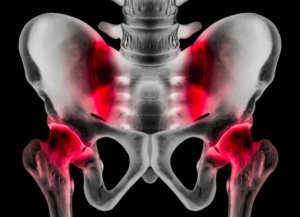 Athletic Pubalgia: Causes, Symptoms, and Treatment