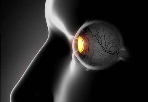 Crossed Eyes: Symptoms and Treatments